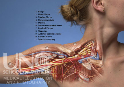 Brachial Plexus Injury Symptoms Wikipedia